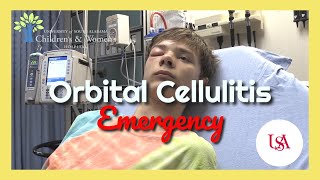 Orbital Cellulitis Emergency [upl. by Moira574]