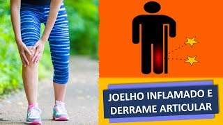 JOELHO INFLAMADO E DERRAME ARTICULAR [upl. by Wattenberg]