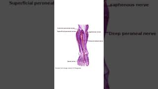 Common peroneal nerve lesion  features [upl. by Beisel]