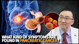 What kind of symptoms are found in Pancreatic Cancer [upl. by Daley]