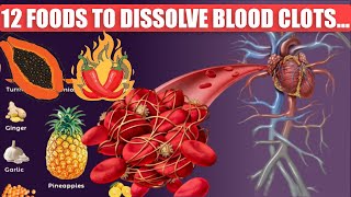 12 Foods That Dissolve Blood Clots Naturally  Amazing Tips [upl. by Merna]