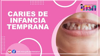 Caries de Infancia Temprana  Tele IEC [upl. by Ecidnarb617]