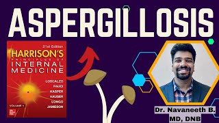 ASPERGILLOSIS  Pathogenesis  Clinical Features  Diagnosis  Treatment  Harrison [upl. by Oileduab]