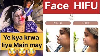 Face HIFU Treatment krwya  Shadi pay jane ke Taiyari end hoi  Sweejackvlogs [upl. by Monney]