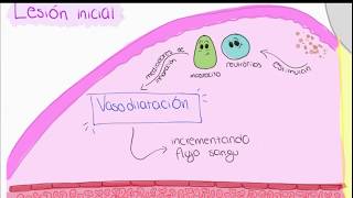 Patogénesis de la enfermedad periodontal [upl. by Jacinta]