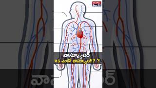 Vascular vs Endovascular Surgery l Dr Nishan Reddy shorts MedPlusONETV [upl. by Doran]