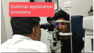 Applanation Tonometrydratulbihade [upl. by Geri]