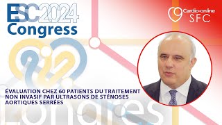 Évaluation chez 60 patients du traitement non invasif par ultrasons de sténoses aortiques serrées [upl. by Alarice]