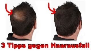 3 Tipps gegen Haarausfall [upl. by Oiramd]