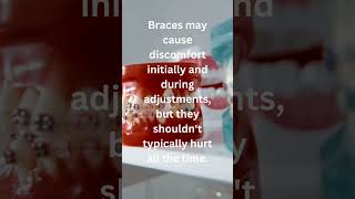 Do Braces REALLY Hurt [upl. by Fisuoy]