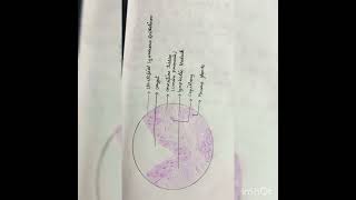 microanatomy of tonsils histology of tonsilsembryology mbbs1styear [upl. by Chessy]