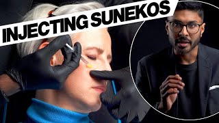 Sunekos Performa Injection Technique Face [upl. by Lotz]