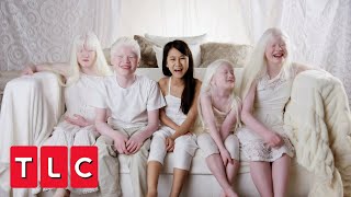 This Couple Adopted Four Children With Albinism  Born with Albinism [upl. by Ikeda]