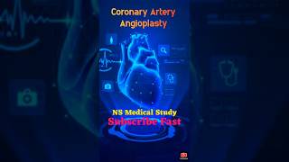 Angiography VS Angioplasty Surgery  Doctor life  viralvideo doctor shorts [upl. by Biagio]