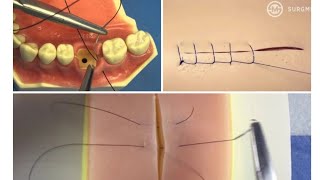 suture techniques شرح نظرى وعملى كامل [upl. by Rolyks]