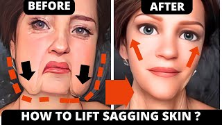 HOW TO LIFT SAGGING SKIN  GET RID OF JOWLS amp LAUGH LINES  REMOVE WRINKLES [upl. by Sumner444]