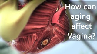 How can aging affect Vagina [upl. by Eads]