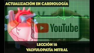 16 VALVULOPATÍA MITRAL [upl. by Elyrehc]