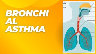 TOPIC15quotBRONCHIAL ASTHMA ITS SYMPTOMS DIAGNOSIS AND TREATMENT [upl. by Flss]