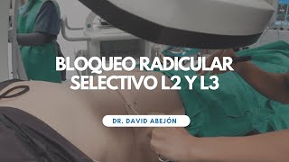 Bloqueo radicular selectivo L2 y L3 [upl. by Ennaegroeg]