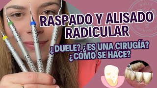 Raspado y alisado radicular PASO A PASO en 2024 🦷✅ [upl. by Otreblon]