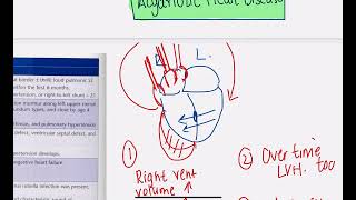 Paediatrics Cyanotic vs Acyanotic Congenital heart diseases [upl. by Pettit451]