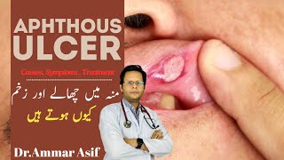 Why You Keep Getting Mouth Sores Aphthous Ulcers [upl. by Saks746]