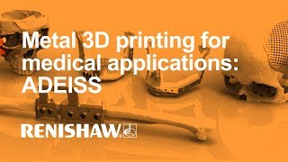 Metal 3D printing for medical applications ADEISS [upl. by Thomajan]