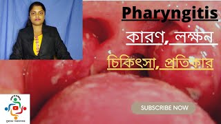 Pharyngitis In Bangla  Causes  Treatments  Home Remedies [upl. by Munro349]