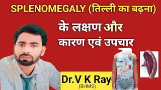 तिल्ली प्लीहा लक्षण कारण इलाज और निदान splemomegaly treatment in hindi 💯✅ [upl. by Drahnreb674]