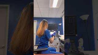 Day in the life of a Sonographer sonography ultrasoundtech ultrasound healthcarejobs [upl. by Adnahsam]