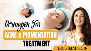 Dermapen Microneedling For Acne Scars Open Pores Wrinkles amp Pigmentation Treatment  AAYNA Clinic [upl. by Rifkin]