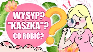 Wysyp Kaszka Co robić  Propozycje kosmetyków [upl. by Henigman675]