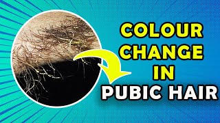 Get rid of colour change in pubic hair and under arm hair Trichomycosis [upl. by Hpsoj]