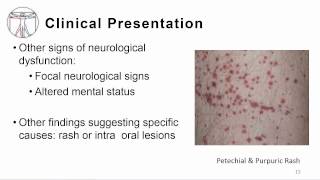 1 Overview meningitis and encephalitis [upl. by Allez]