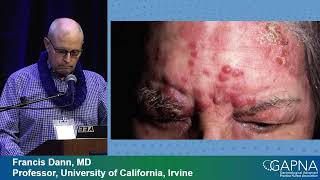 Treatment of Common Dermatologic Problems in Older Adults Preview [upl. by Erdnoid]