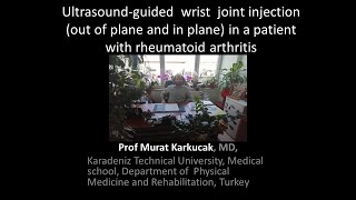 Ultrasoundguided wrist joint injection in a patient with rheumatoid arthritis [upl. by Alarice]