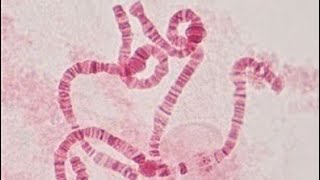 Polytene chromosome of Chironomus sp [upl. by Llered]