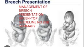 Management of Breech Presentation Greentop Guideline No 20b summary obgyneLearning [upl. by Mullins]