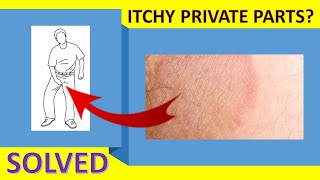 How To Cure Itching Near Private Parts  Itchy Groin Area Home Remedy [upl. by Yuk466]