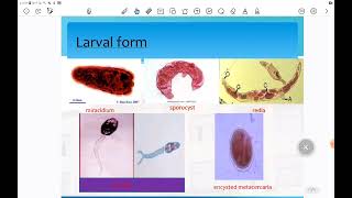 Trematodes Hetrophyes hetrophyes [upl. by Orimlede]