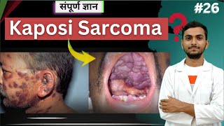 quotUnderstanding Kaposi Sarcoma Symptoms Causes and Treatmentquot cancer viralinfection Mltwallah [upl. by Ihsoyim]