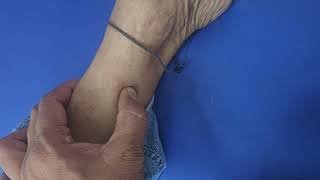 Peripheral Vascular Pulse Examination imwell [upl. by Eltsirk]