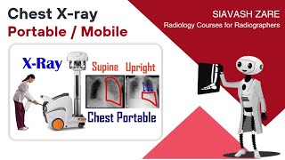 Chest Xray Portable upright semiupright supine Positioning and Technique [upl. by Yedok]