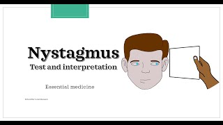 Nystagmus  test and interpretation Essential medicine [upl. by Minnie939]