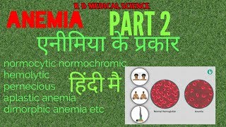 Anemia amp its types simple एक्सप्लनेशन हिंदी ANEMIA PART 2 [upl. by Pavyer13]