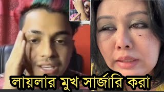 লায়লার মুখ সার্জারি করালায়লা আমাকে মারছেলাইভে মামুন কি বলছে দেখুন [upl. by Rusel]