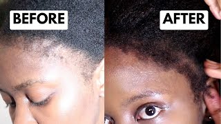 EDGES  HAIRLINE RECOVERY  8 TIPS on how I’m doing it  South African YouTuber [upl. by Kissee77]