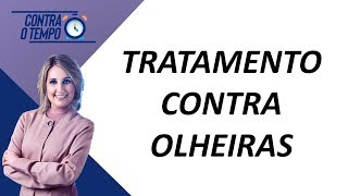 Olheiras e Tratamento  Conheça seus tipos e forma de tratar [upl. by Hough]