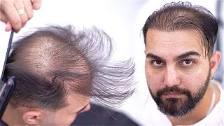 Barbers Magic on a Live Model 👨‍🦲✂️ I Transforming Thinning Hair [upl. by Daukas411]